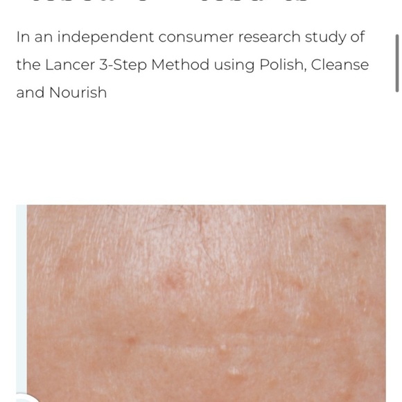 EXTRA LG LANCER THE METHOD CLEANSER NORMAL TO COMBO SKIN 100% AUTHENTIC 4.5FL OZ - Picture 9 of 13